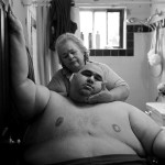 A Life Apart: The Toll of Obesity 1